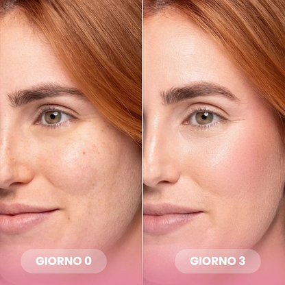 DermaVeil™