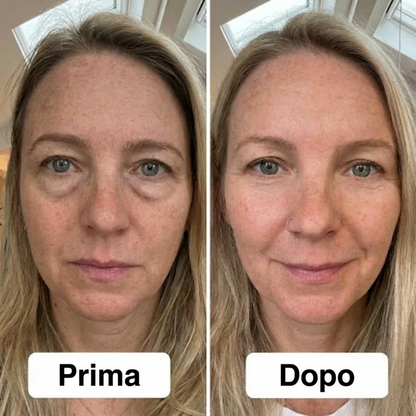 Luminéa EyeLift™