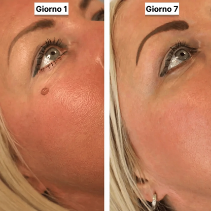 DermaPro™
