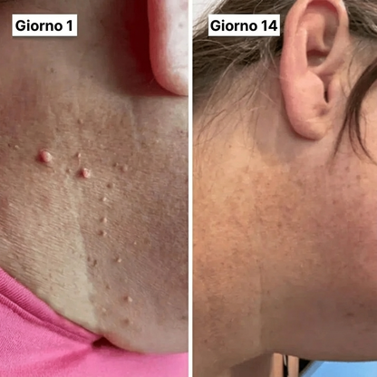 DermaPro™