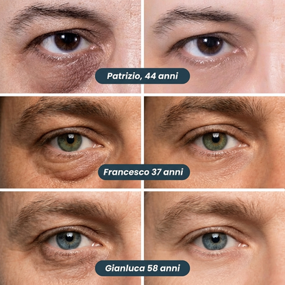 Perfiorna™
