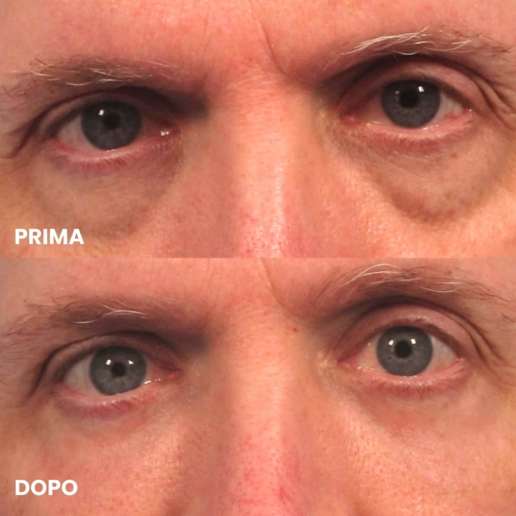 Perfiorna™