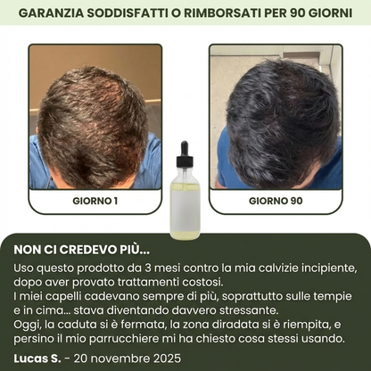 Follicèra Uomo™