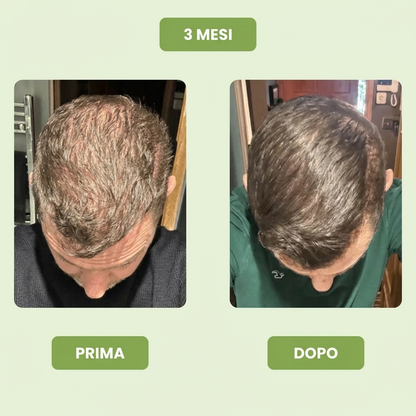 Follicèra Uomo™