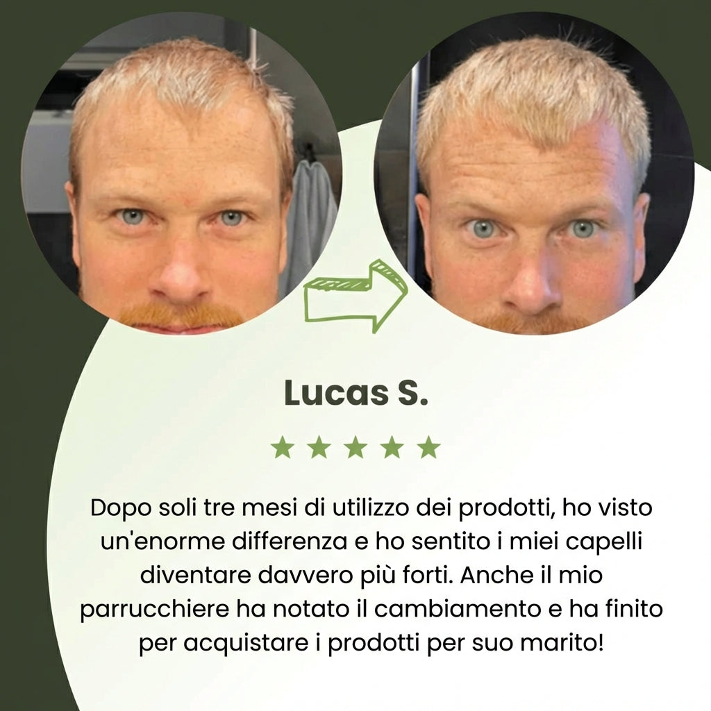 Follicèra Uomo™