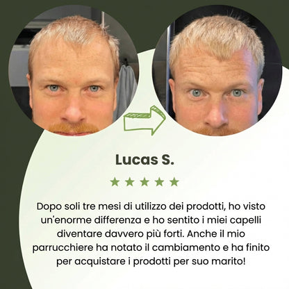 Follicèra Uomo™