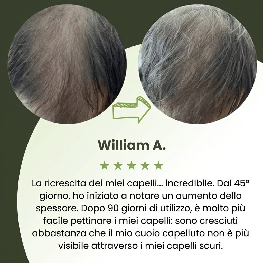 Follicèra Uomo™