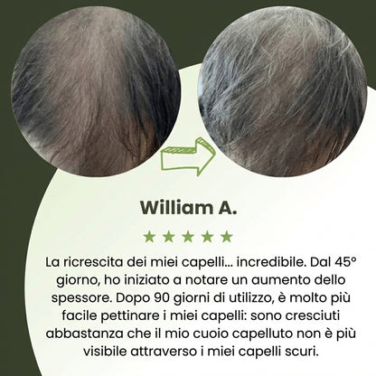 Follicèra Uomo™