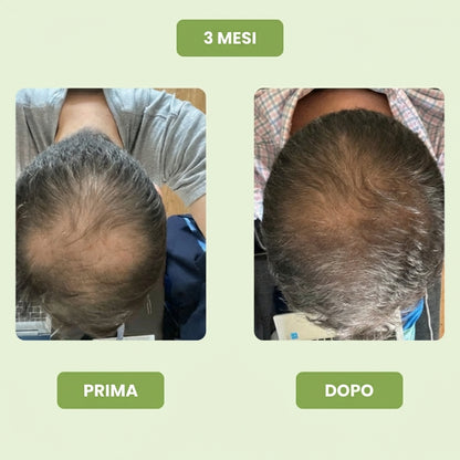 Follicèra Uomo™