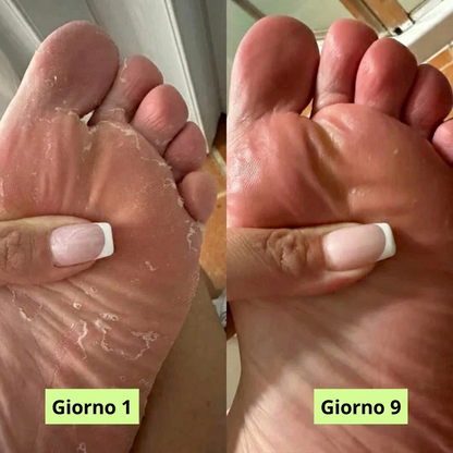 Micotera Pure™