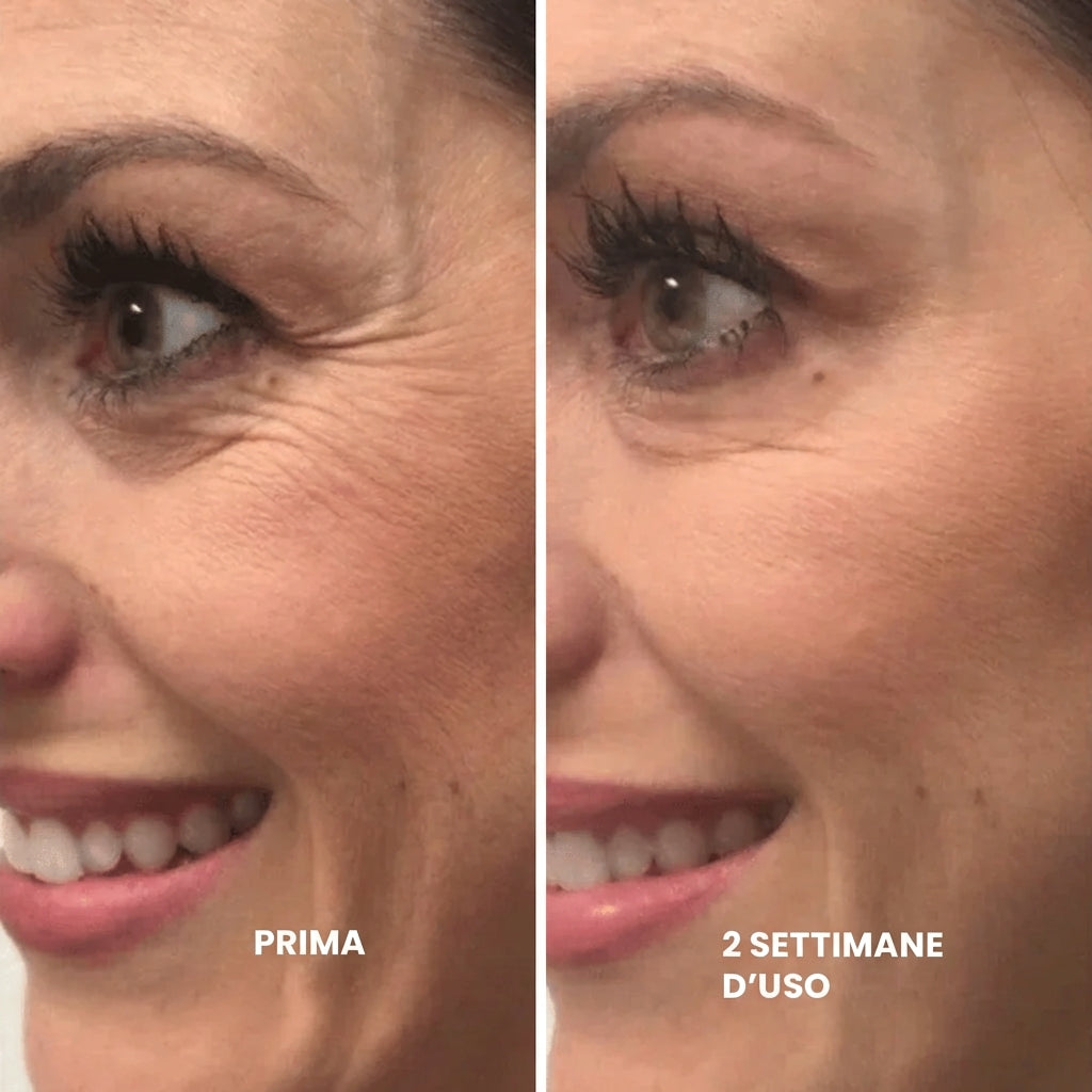 Retinélia Suprema™