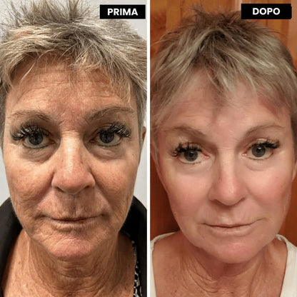 Retinélia Suprema™