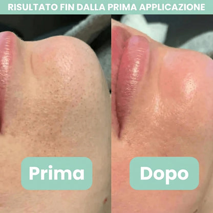 PureRiso™