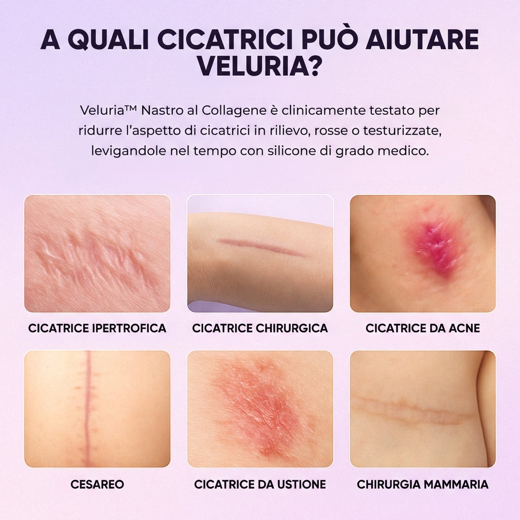 Veluria™