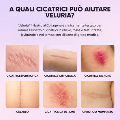 Veluria™