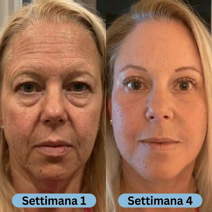 SeruLift™