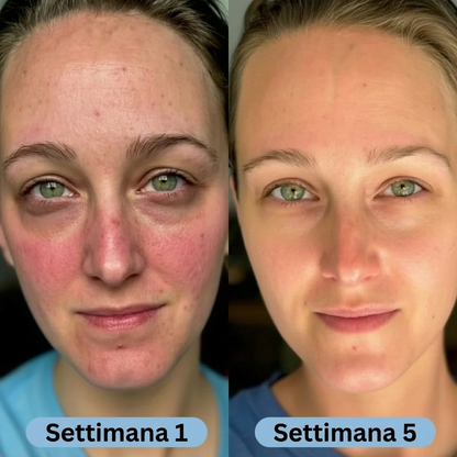 SeruLift™