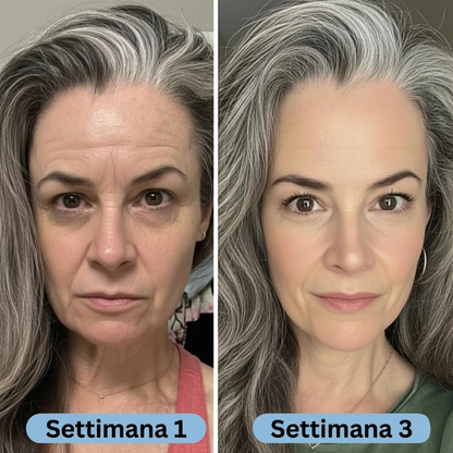 SeruLift™