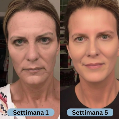 SeruLift™