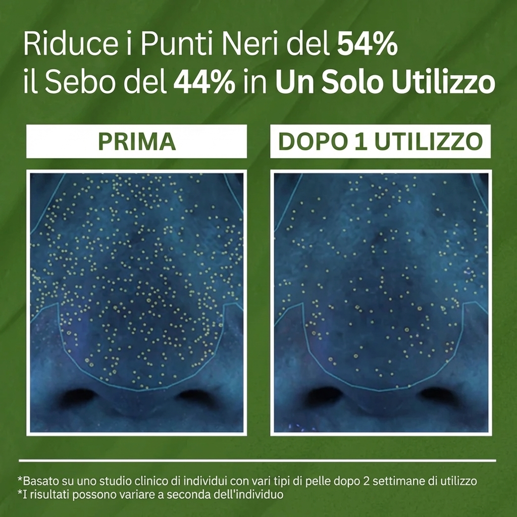 Purelia™