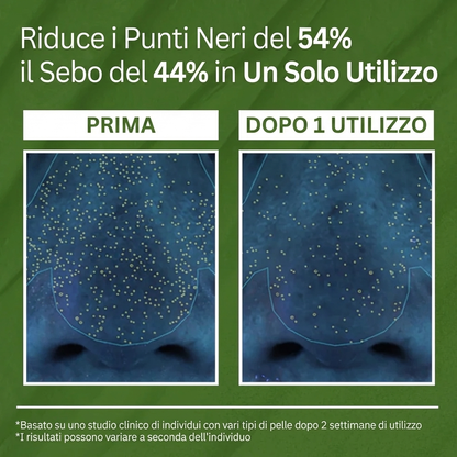 Purelia™