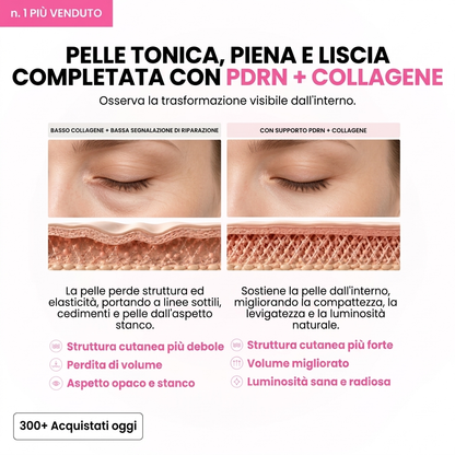 Colmea