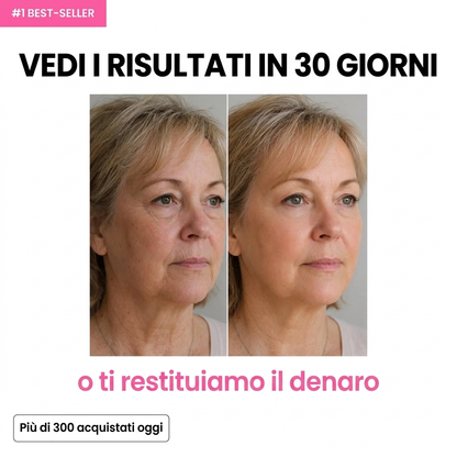 Colmea